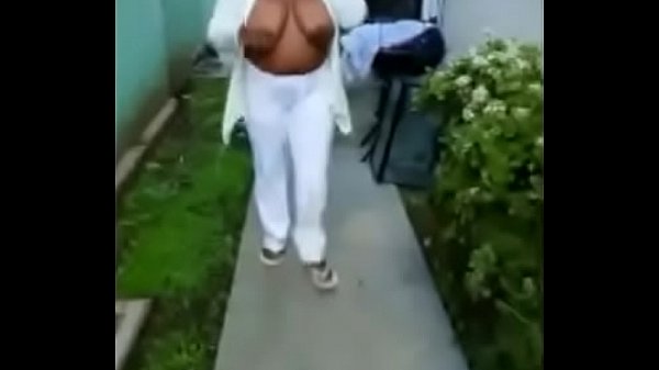 Breast visible in public