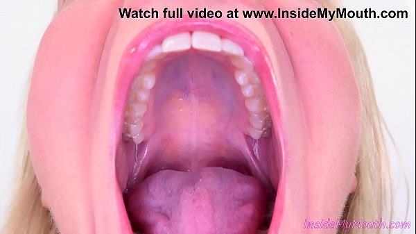 Girl uvula mouth