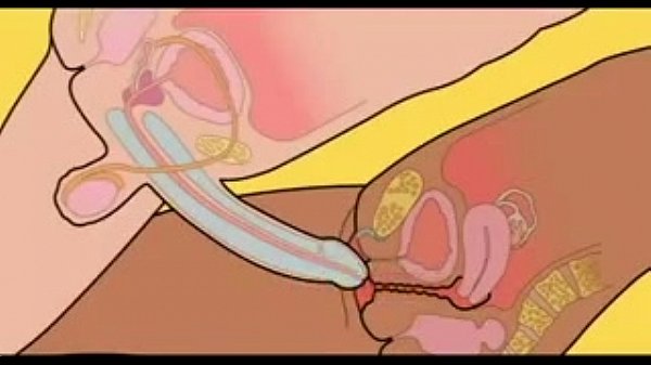 How to put penis in vagina