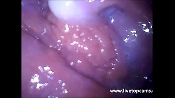 Inside vagina camera